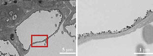 Images captured by transmission electron microscopy (TEM)