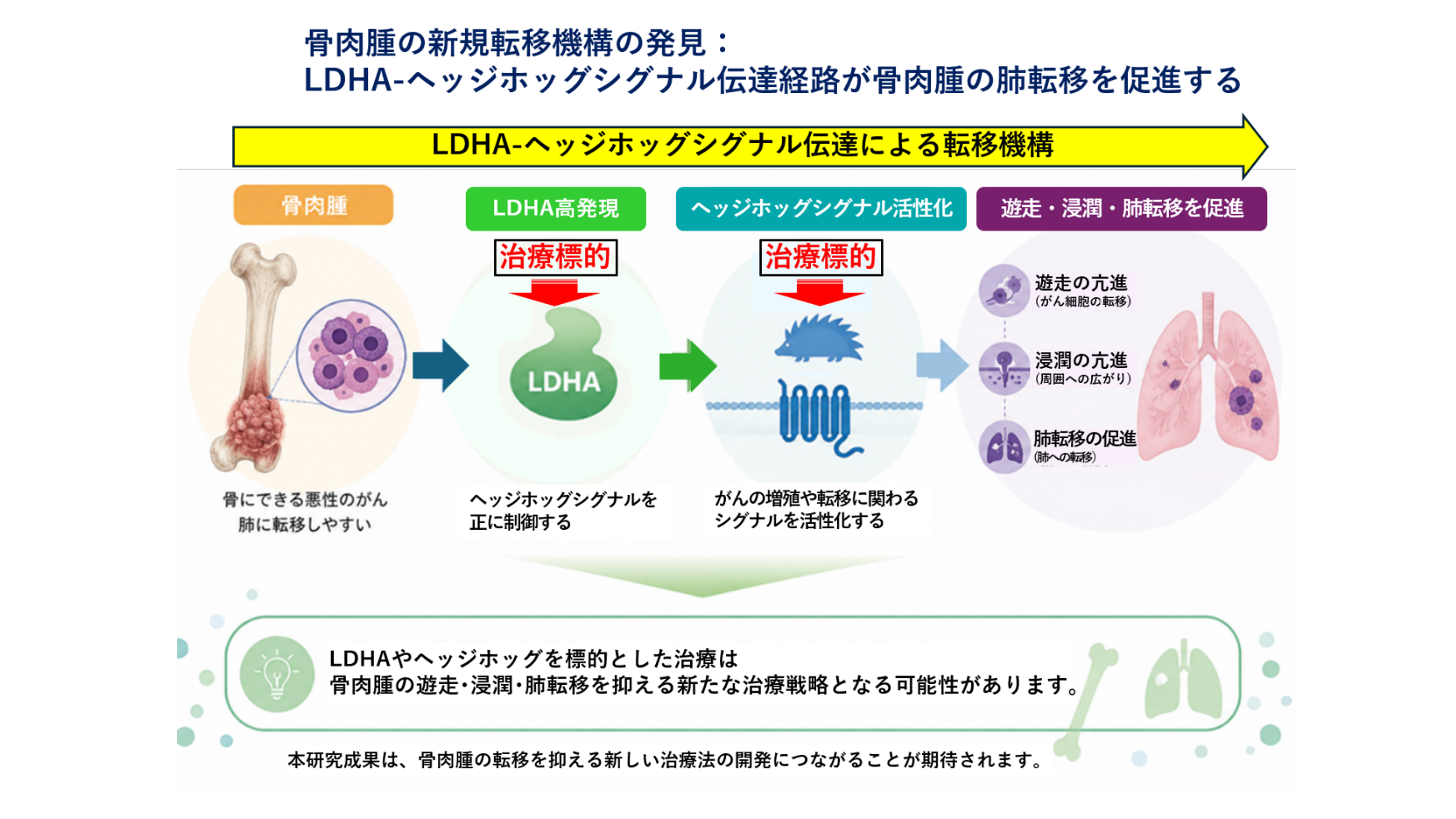 骨肉腫の「肺転移」を抑制するメカニズムを解明：骨肉腫の新規治療標的