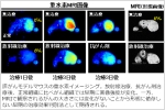 重水素MRIを用いたがん治療効果の早期予測法を開発 がん治療における治療効果の早期診断法として期待